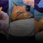 Transforming Confidence: A Dubai Patient’s Subtle Recovery