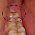 A Bright Smile Journey in Rajkot