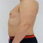 Nexus Clinic: Trusted MOH-Approved Aesthetics and Wellness