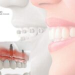 Dentista Pozuelo Avenida Europa | Clínica Vilar Sancho