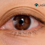 How to Cure Pterygium: Practical Tips and Treatments