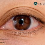 Surgery For Pterygium | Pterygiumhouston.com