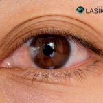 Pterygium Surgery Recovery: What to Expect and Tips