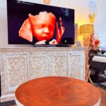 4D Scan Perth – See Your Baby Move at Cedar4D Ultrasound
