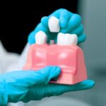 Dental crown in Indian Land SC | Carolinasmiledentistry