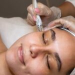 Chemical Peels Oakville | Reveal radiant skin at Skin Beauty & Beyond